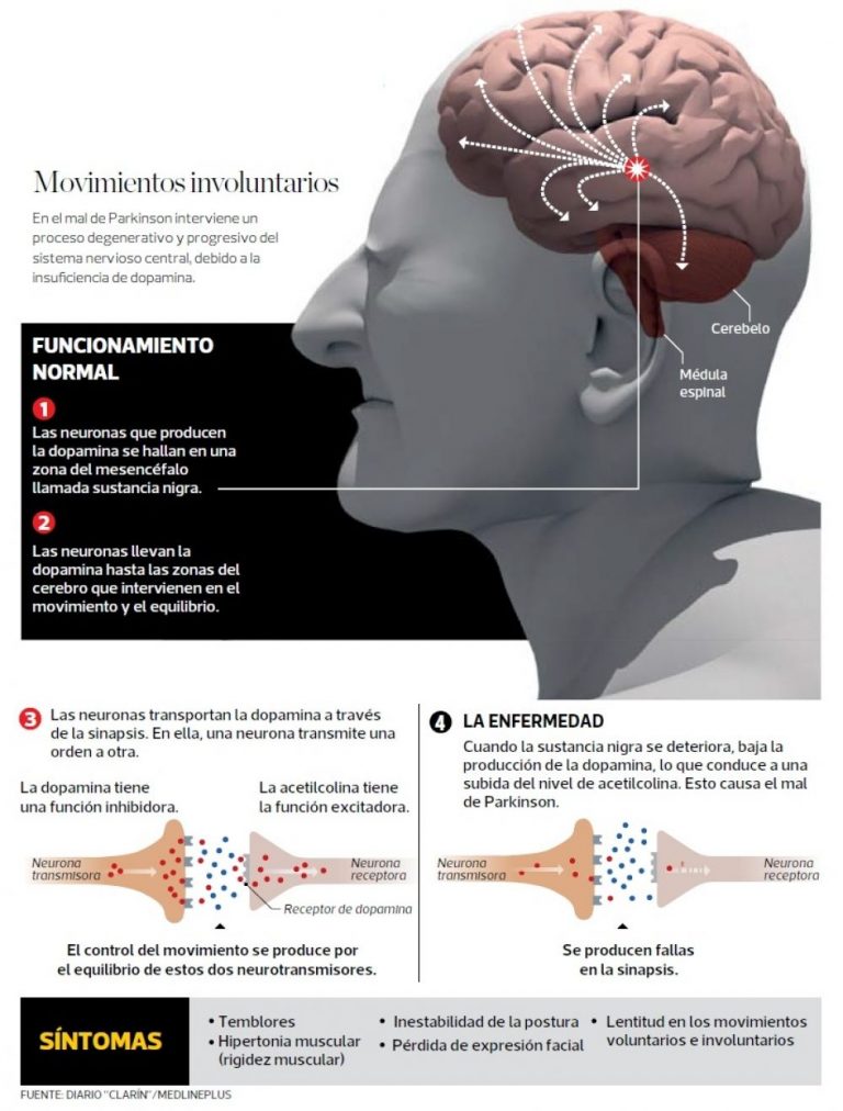UNA NUEVA MIRADA AL MAL DE PARKINSON